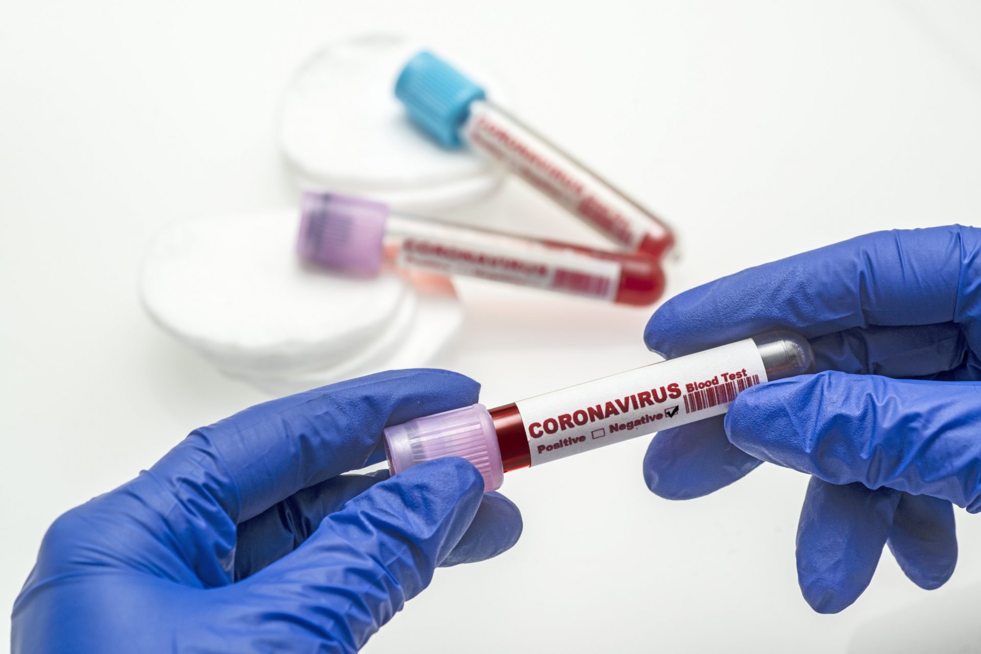 coronavirus test