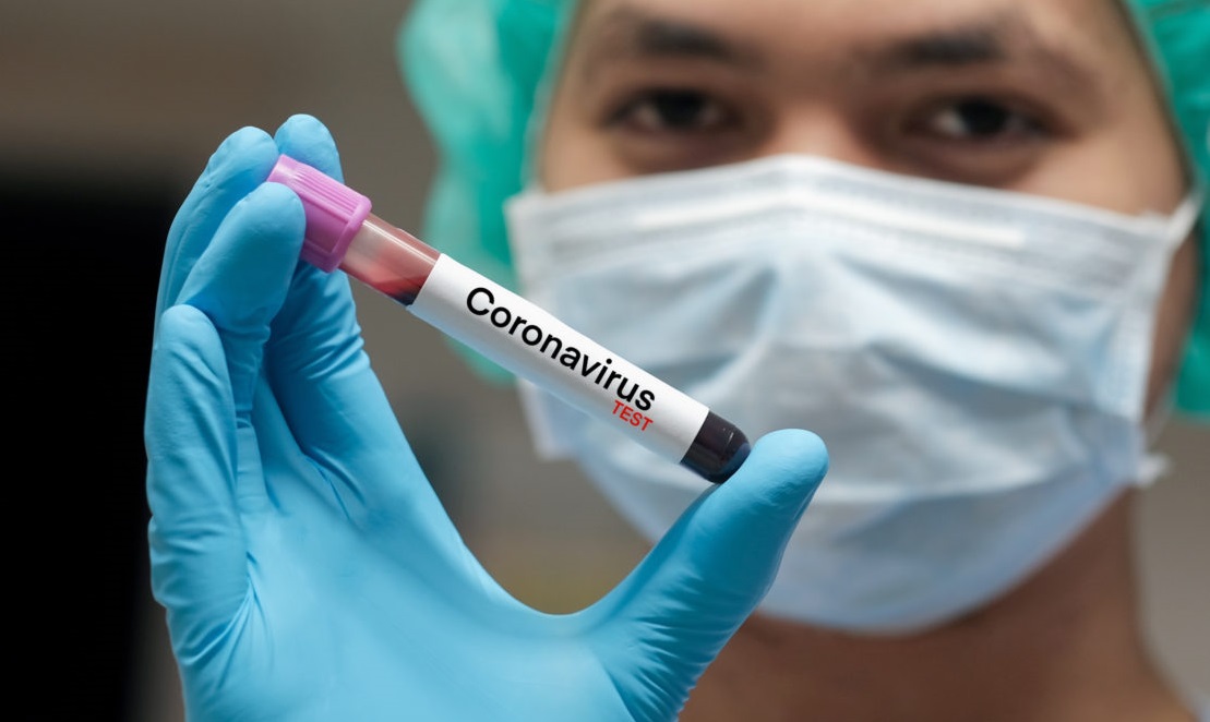 Coronavirus1